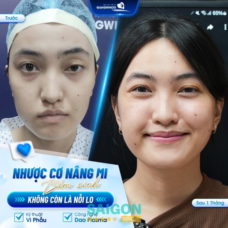 Bệnh viện thẩm mỹ Gangwhoo TPHCM