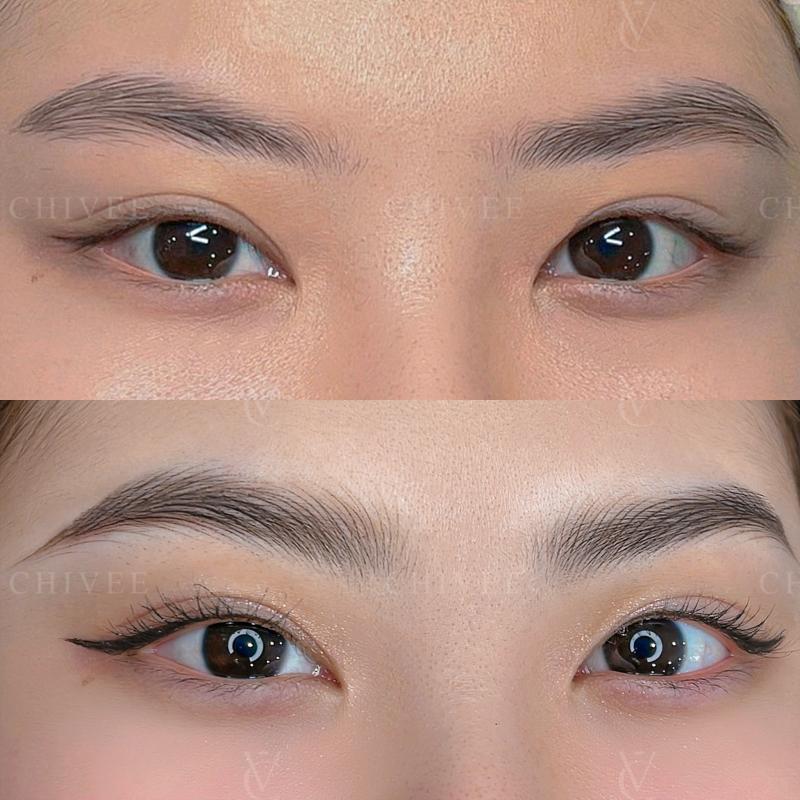 Viện Thẩm Mỹ ChiVee